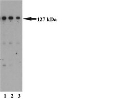 MSH3 Mouse anti-Human, Unlabeled, Clone: 52, BD 50 &mu;g | Buy Online | BD Biosciences | Fisher Scientific