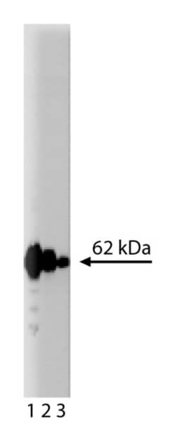 p62 Ick ligand Mouse anti-Human, Unlabeled, Clone: 3, BD 150&mu;g; Unlabeled:Antibodies,