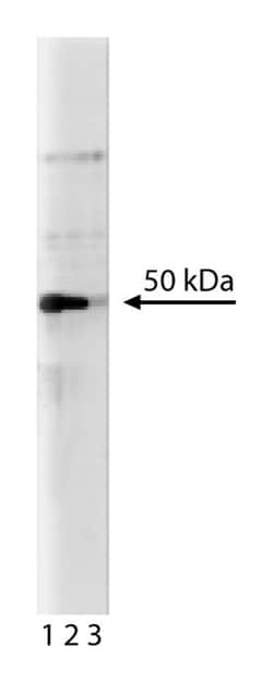 Pax-5 Mouse, Unlabeled, Clone: 24, BD 50μg; Unlabeled:Antibodies, Monoclonal