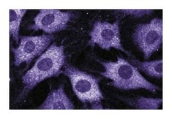 p67 (phox) Mouse, Unlabeled, Clone: 29, BD:Antibodies:Primary Antibodies