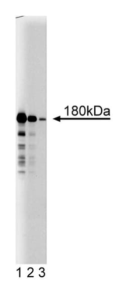 ROCK-II Mouse, Unlabeled, Clone: 21, BD 150&mu;g; Unlabeled:Antibodies,