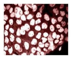 Phosphoserine/threonine Mouse, Unlabeled, Clone: 22A, BD:Antibodies:Primary