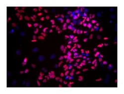 SOX-17 Mouse anti-Human, Alexa Fluor 647, Clone: P7-969, BD 50 Tests | Buy Online | BD Biosciences | Fisher Scientific