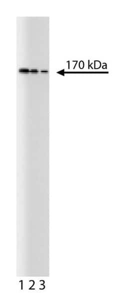 Topo II Mouse anti-Human, Unlabeled, Clone: 31, BD:Anticuerpos:Anticuerpos