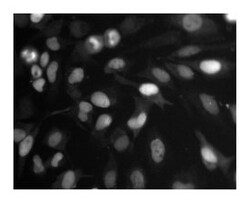 Topo II Mouse anti-Human, Unlabeled, Clone: 31, BD:Anticuerpos:Anticuerpos