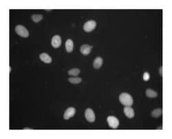 Topo II Mouse anti-Human, Unlabeled, Clone: 40, BD 150&mu;g; Unlabeled:Antibodies,