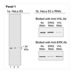 VHL Mouse anti-Human, Unlabeled, Clone: S2-647, BD 0.1mg; Unlabeled:Antibodies,
