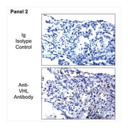 VHL Mouse anti-Human, Unlabeled, Clone: S2-647, BD 0.1mg; Unlabeled:Antibodies,