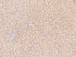 Sino Biological Anti-Factor XI Antibody, Rabbit Polyclonal, Quantity: Each