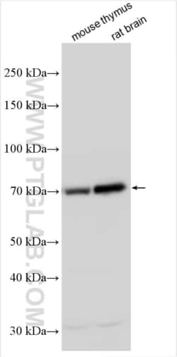 FAM134A Rabbit, anti-Human, Polyclonal, Proteintech Quantity: 150 &mu;L:Antibodies