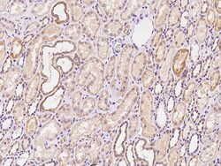 Sino Biological Anti-FAM46A Antibody, Rabbit Polyclonal, Quantity: Each