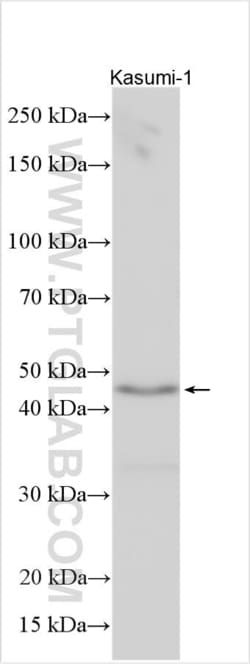 FAM54A Rabbit, anti-Human, Polyclonal, Proteintech Quantity: 150 &mu;L:Antibodies