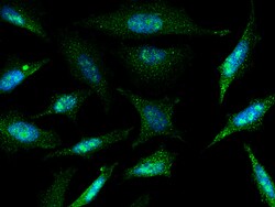 Sino Biological Anti-Fas Ligand/TNFSF6 Antibody, Rabbit Polyclonal, Quantity: