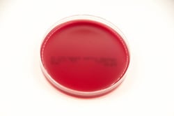 Anaerobe Systems BRU, PEA, BBE/LKV - Brucella Blood Agar, Phenylethyl Alcohol