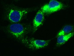 Sino Biological Recombinant Anti-Fetuin A/FETUA Antibody, Rabbit Monoclonal,