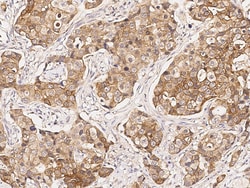 Sino Biological Fragile histidine triad / FHIT Antibody, Rabbit PAb, Antigen