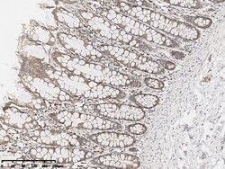 Sino Biological FHIT Antibody, Rabbit PAb, Antigen Affinity Purified 100uL,