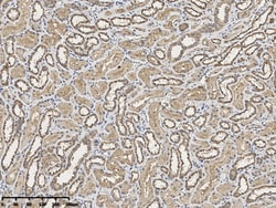 Sino Biological FHIT Antibody, Rabbit PAb, Antigen Affinity Purified 100uL,