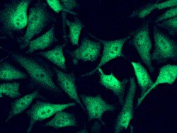 Sino Biological Fragile histidine triad / FHIT Antibody, Rabbit MAb 100µL,