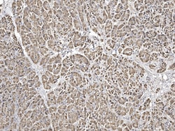 Sino Biological FKBP14 Antibody, Rabbit PAb, Antigen Affinity Purified