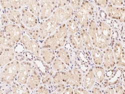 Sino Biological Anti-FOXF1 Antibody, Rabbit Polyclonal, Quantity: Each