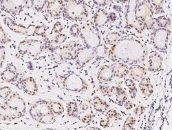 Sino Biological Anti-FOXK1 Antibody, Rabbit Polyclonal, Quantity: Each