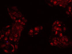 Sino Biological Anti-FOXP2 Antibody, Rabbit Polyclonal, Quantity: Each