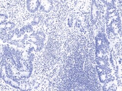 Sino Biological Human FOXP3 MAb 100ul (Sino Biological), Quantity: Each