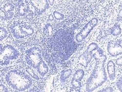 Sino Biological Human FOXP3 MAb 100ul (Sino Biological), Quantity: Each
