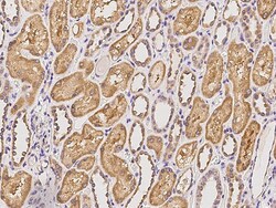 Sino Biological Anti-FRMPD2 Antibody, Rabbit Polyclonal, Quantity: Each