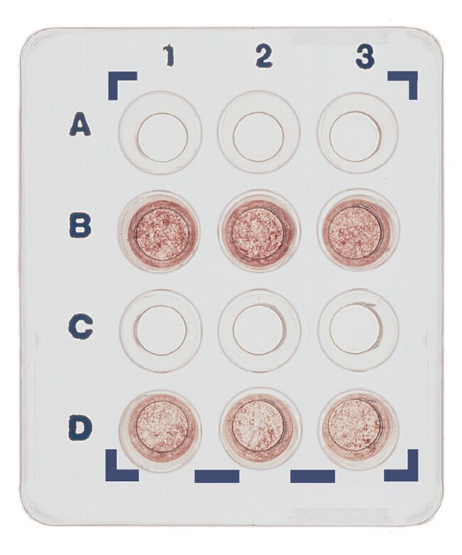 Edvotek AIDS Kit I Simulation of HIV1 Detection HIV1 DetectionTeaching