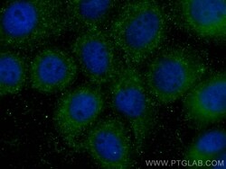 FUT4 Rabbit, anti-Human, CoraLite Plus 488, Polyclonal, Proteintech:Anticuerpos:Anticuerpos