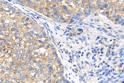 Fibroblast activation protein alpha Rabbit, anti-Human, Polyclonal, Proteintech