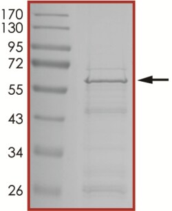 Sino Biological&nbsp;Recombinant Human GNA13 Protein (Full Length, GST Tag)