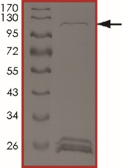 Sino Biological&nbsp;Recombinant Human GUCY2F Protein (GST Tag)