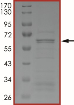 Sino Biological&nbsp;Recombinant Human GNAZ Protein (GST Tag)