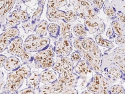 Sino Biological Anti-Galectin-1/LGALS1 Antibody, Mouse Monoclonal, Quantity: