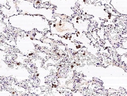 Sino Biological Galectin-3 / LGALS3 Antibody, Rabbit MAb 100uL, Quantity: