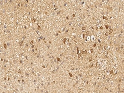 Sino Biological GALNT2 / GalNAc-T2 Antibody, Rabbit PAb, Antigen Affinity