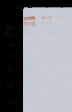 Sino Biological Human cytomegalovirus (HCMV) Glycoprotein B / gB Antibody,