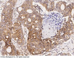 Sino Biological Anti-GDF5 Antibody, Rabbit Polyclonal, Quantity: Each of