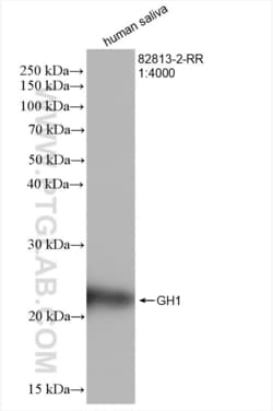 GH1 Rabbit, anti-Human, Clone: 4G8, Proteintech Quantity: 20 &mu;L:Antibodies