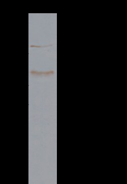 Sino Biological alpha-Galactosidase A / GLA Antibody, Rabbit MAb 100uL,