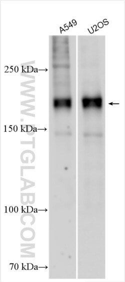 GLI2 Rabbit, anti-Human, Polyclonal, Proteintech:Antibodies:Primary Antibodies