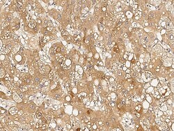 Sino Biological GLIPR1 / RTVP1 Antibody, Rabbit PAb, Antigen Affinity Purified