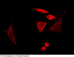 Sino Biological Anti-GMF Beta/GMFB Antibody, Rabbit Polyclonal, Quantity: