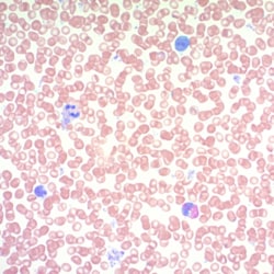 Scytek Laboratories Giemsa Stain Kit (May-Grunwald): Large, Quantity: Each