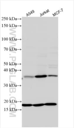 GNB1L Rabbit, anti-Human, Polyclonal, Proteintech Quantity: 150 &mu;L:Antibodies