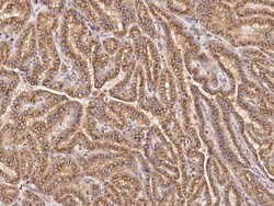 Sino Biological Anti-GM130/GOLGA2 Antibody, Rabbit Polyclonal, Quantity:
