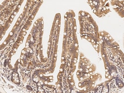 Sino Biological Anti-GORASP2 Antibody, Rabbit Polyclonal, Quantity: Each